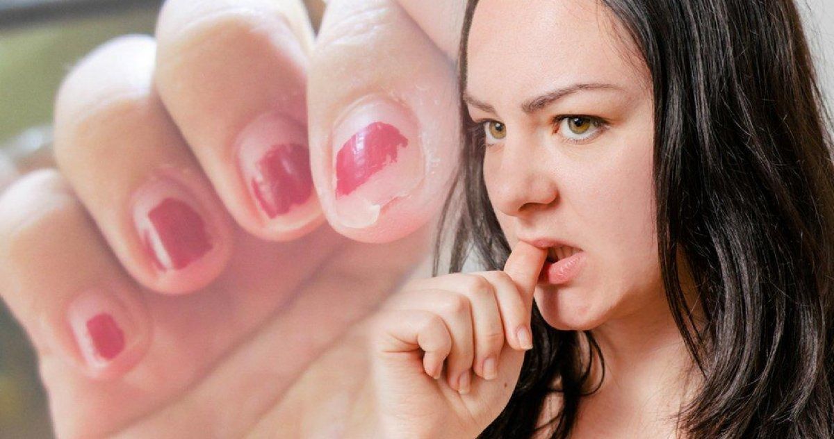 Sin duda se trata de un mal hábito que puede ser perjudicial para la salud