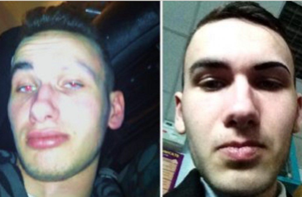 Acude a su primera entrevista de trabajo tras perder una ceja y su experiencia se hace viral