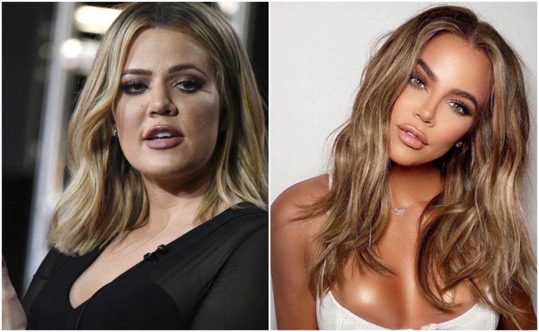 Khloé Kardashian