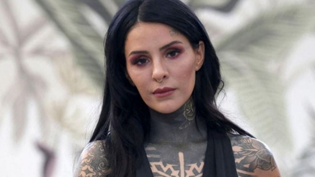Cande Tinelli compartió una foto de su brazo vendado y llevó tranquilidad a sus seguidores.