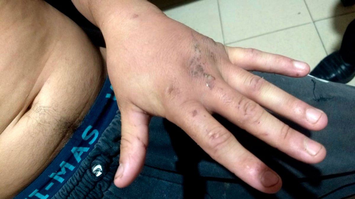El hombre detenido en la ciudad santafesina de Villa Constitución tiene marcas en sus manos de cortes. 
