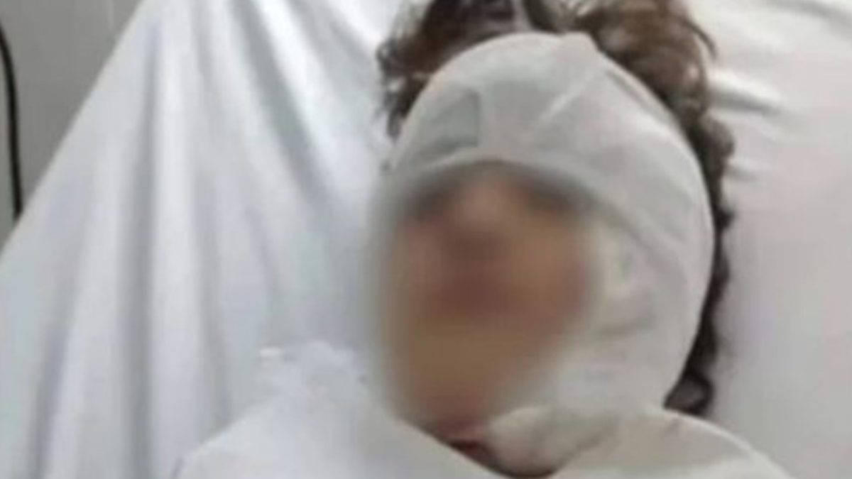 Un pitbull atacó a una niña en Río Gallegos, le desfiguró la cara y deberá someterse a varias cirugías