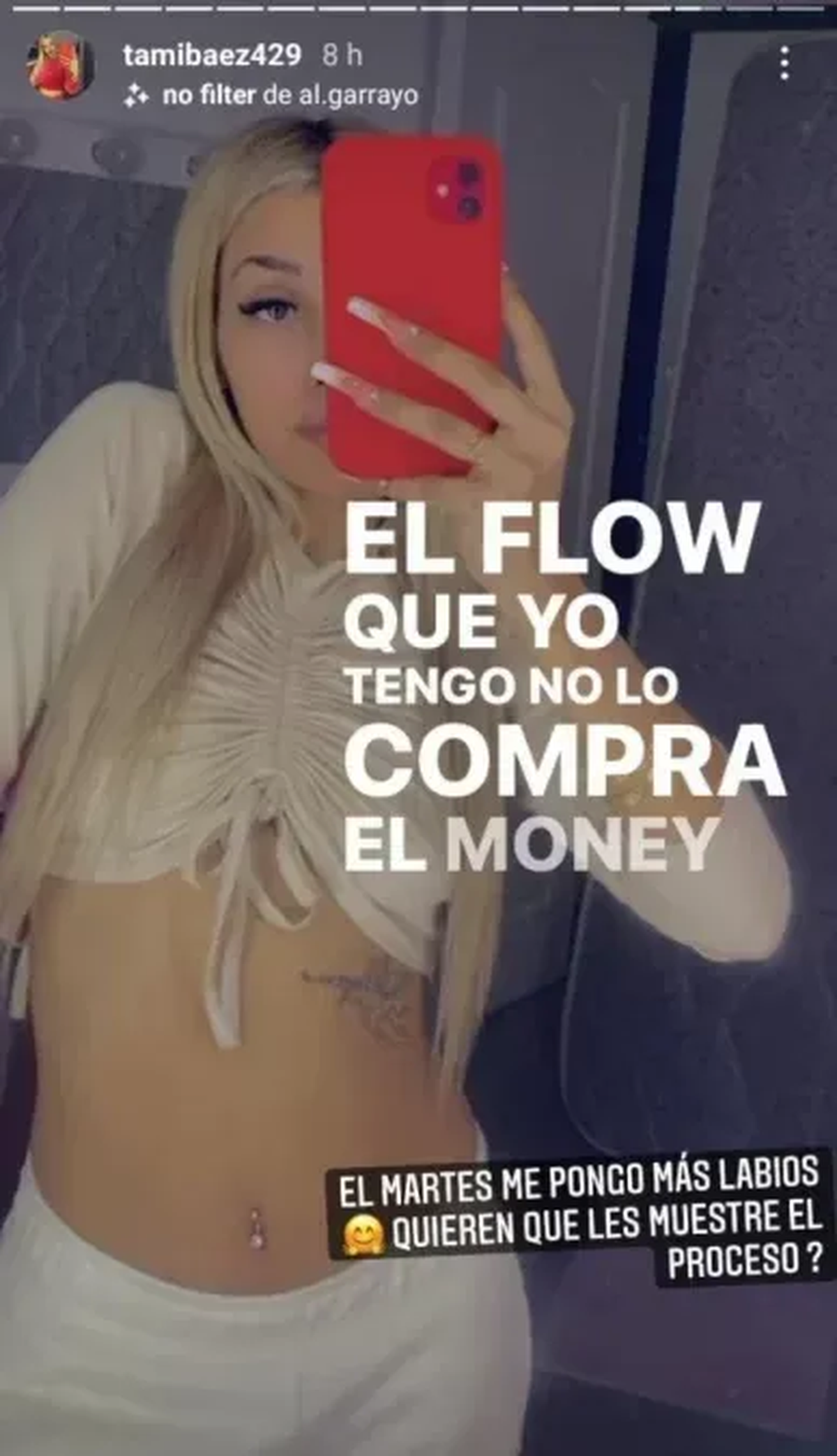 Tamara Báez, la novia de L-Gante, contó cuál será su próximo retoque estético.