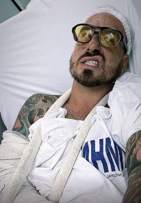 Fede Bal se accidentó en Brasil.