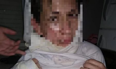 Cintia G. víctima de violencia de género Cintia G. víctima de violencia de género