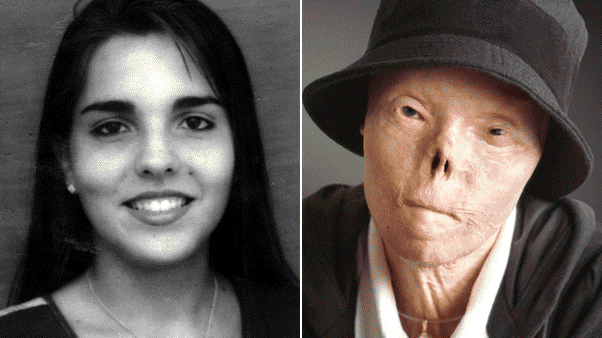 Murió La Mujer Que Se Convirtió En El “rostro De Las Tragedias” Luego De Un Accidente