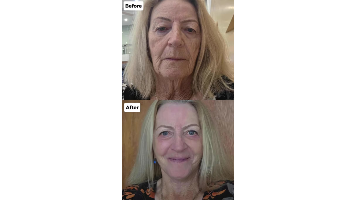 Pamela viajó a Tailandia, la “capital mundial del lifting”, y sorprendió a todos con su cambio radical.