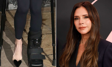 El fuerte accidente de Victoria Beckham que la obliga a tener que usar muletas El fuerte accidente de Victoria Beckham que la obliga a tener que usar muletas