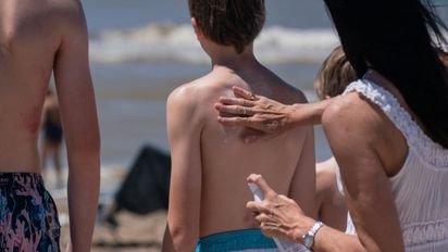 Provincia recuerda cómo proteger la piel durante el verano