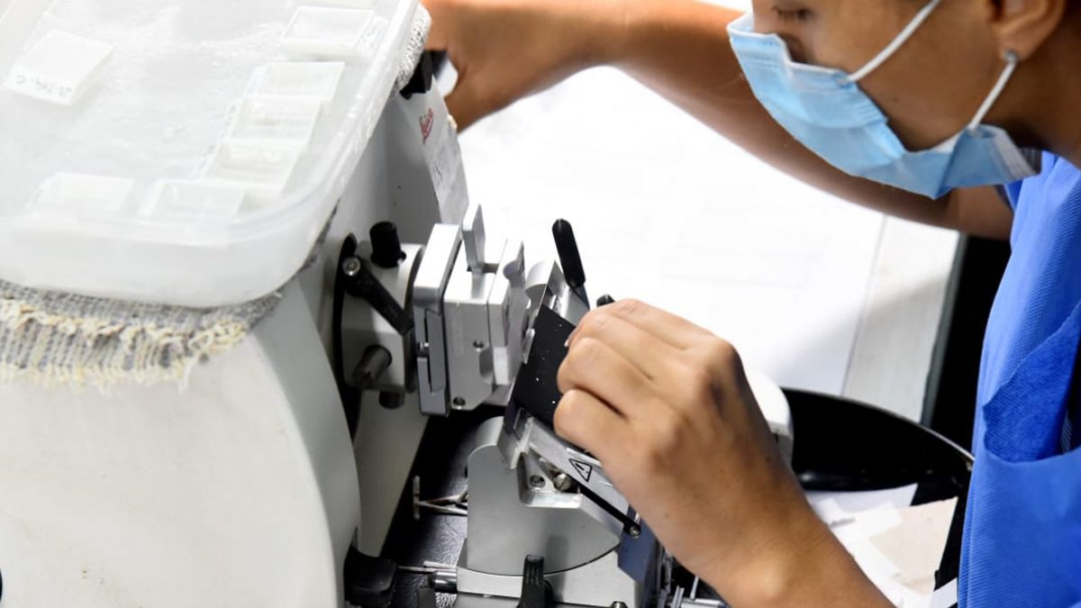 Realizarán pruebas de Papanicolaou sin turno en la semana de la prevención del cáncer de cuello de útero