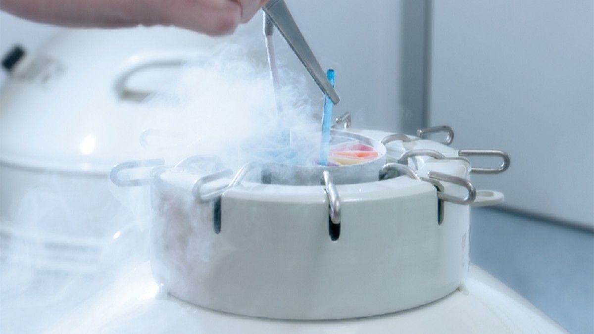 El diagnóstico genético preimplantacional implica que, después de hacer la fecundación in vitro, y antes de la transferencia al útero, se estudia el material genético del embrión para detectar alteraciones genéticas. Luego se realiza una biopsia a cada embrión y se descartan los que tienen una enfermedad congénita. Por último, se transfieren entre uno y dos embriones sanos. Los embriones sanos se pueden congelar. (Imagen ilustrativa) El diagnóstico genético preimplantacional implica que, después de hacer la fecundación in vitro, y antes de la transferencia al útero, se estudia el material genético del embrión para detectar alteraciones genéticas. Luego se realiza una biopsia a cada embrión y se descartan los que tienen una enfermedad congénita. Por último, se transfieren entre uno y dos embriones sanos. Los embriones sanos se pueden congelar. (Imagen ilustrativa)