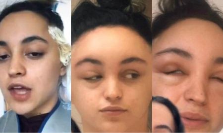 Una joven casi pierde la vida tras pintarse el cabello Una joven casi pierde la vida tras pintarse el cabello