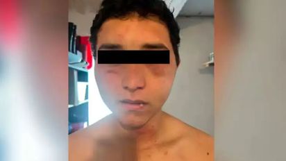 Buenos Aires: un trabajador rural denunció que sus patrones lo torturaron durante una hora y media