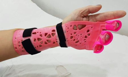 Las férulas ortopédicas termoformadas se producen mediante impresión 3D. Los detalles de la campaña solidaria en Santa Fe. Las férulas ortopédicas termoformadas se producen mediante impresión 3D. Los detalles de la campaña solidaria en Santa Fe.
