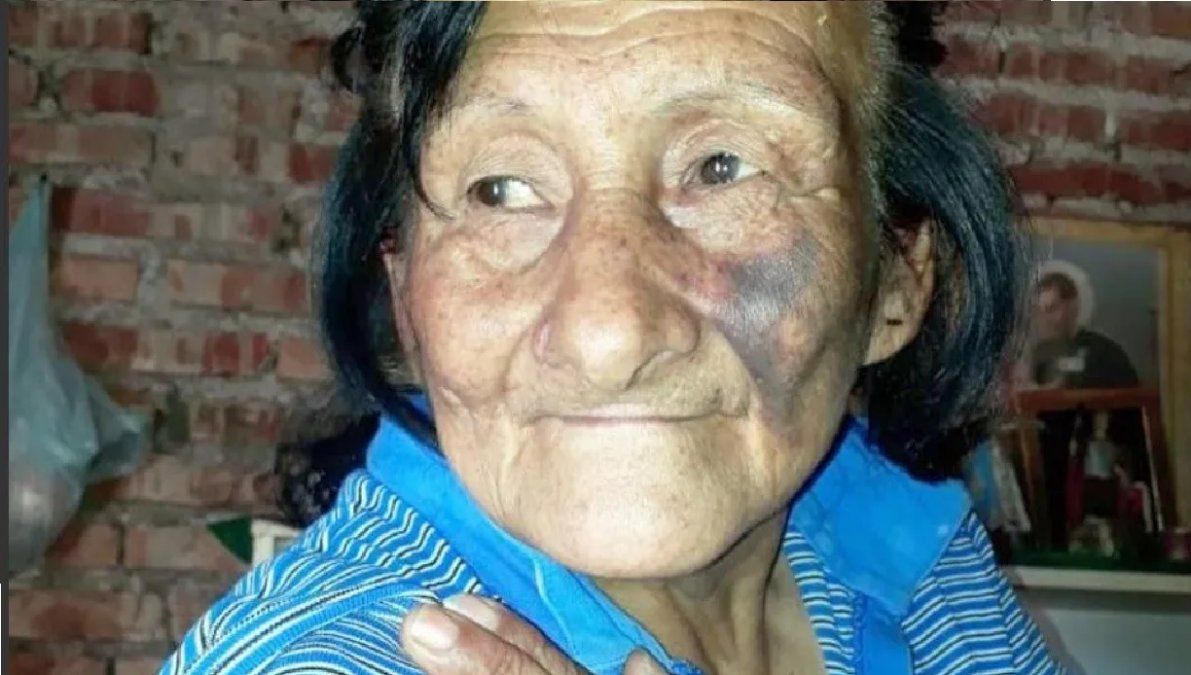 Entró a robar a una casa y molió a golpes con una pala a una sexagenaria: Me podría haber matado