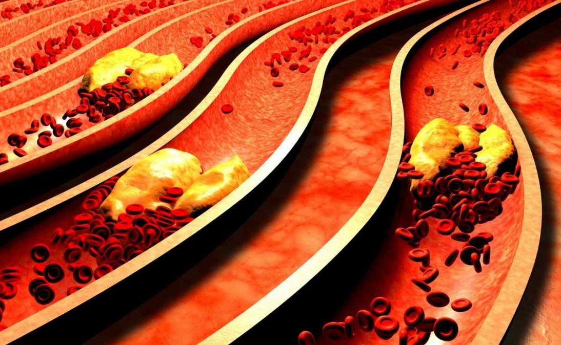 Consumir miel ayuda a disminuir el colesterol