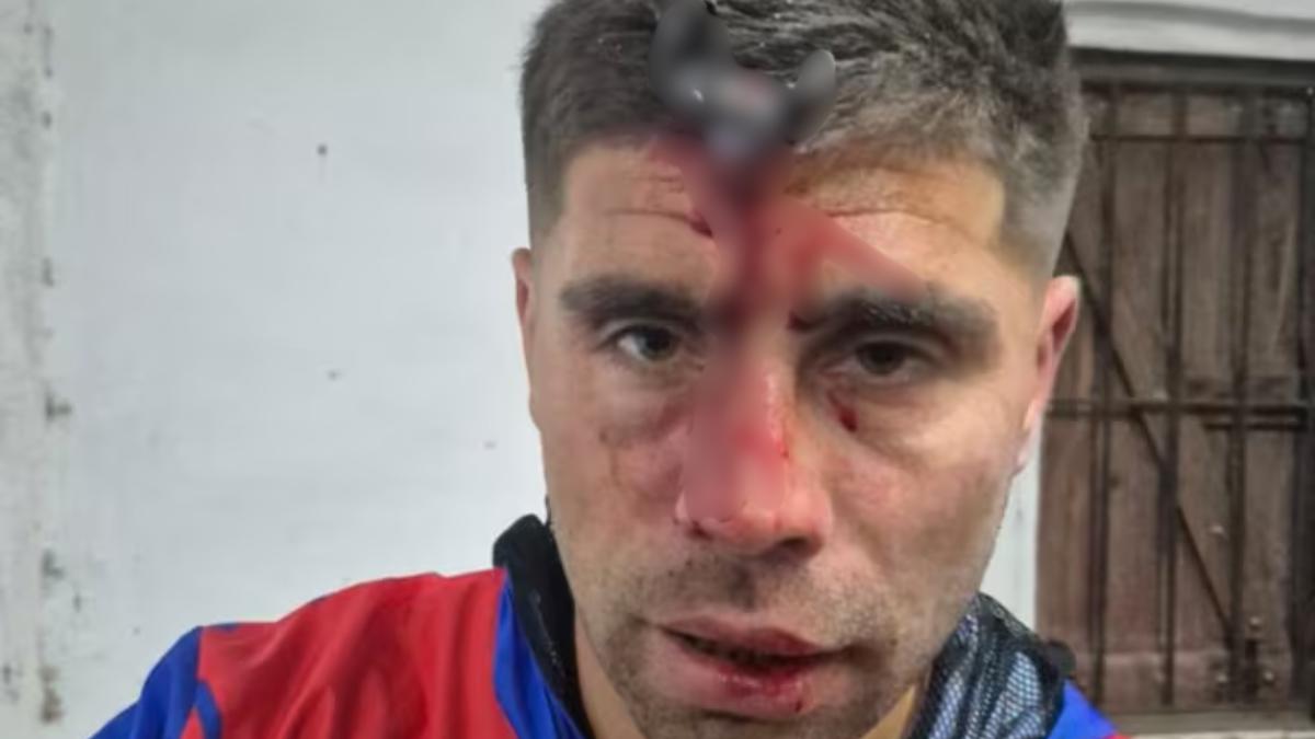 Ataque a Jonathan Smith durante un partido femenino en Berazategui sufrió una fractura de cráneo.
