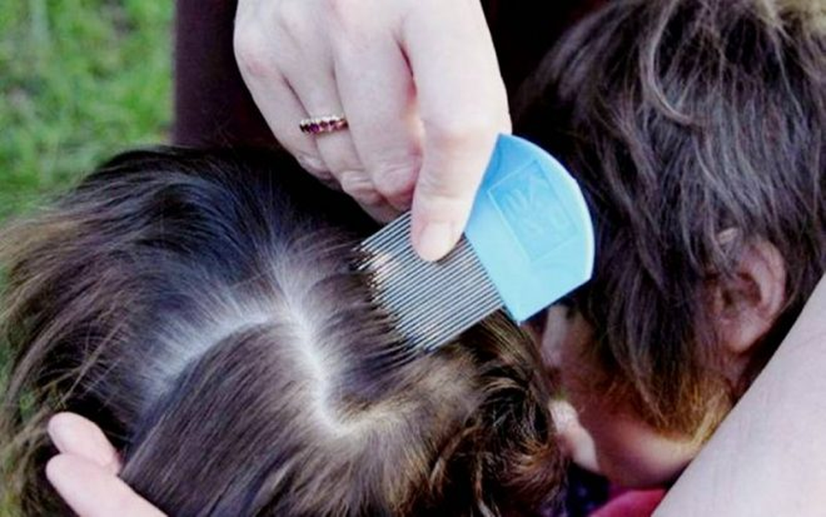 El peine fino es un aliado fundamental a la hora de combatir la pediculosis. El peine fino es un aliado fundamental a la hora de combatir la pediculosis.