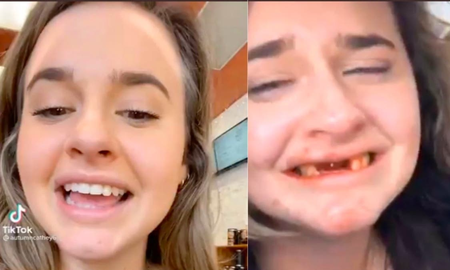 Una joven quiso hacer algo bastante complicado en TikTok, bajo los efectos del alcohol, y perdió sus dientes. Una joven quiso hacer algo bastante complicado en TikTok, bajo los efectos del alcohol, y perdió sus dientes.
