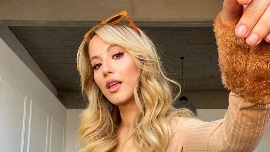 Flor Vigna impactó a sus seguidores al mostrarse con su cara desfigurada