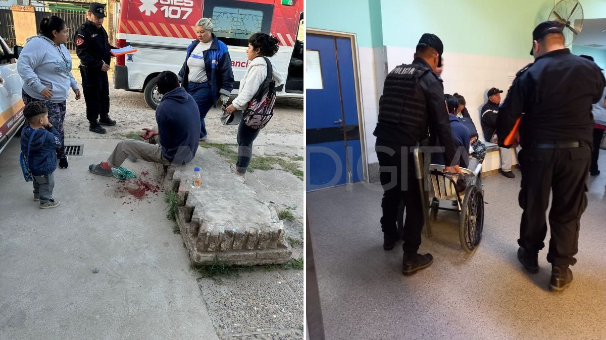 El joven a quien le explotó el dispositivo en la mano, fue trasladado al Hospital Cullen. El joven a quien le explotó el dispositivo en la mano, fue trasladado al Hospital Cullen.