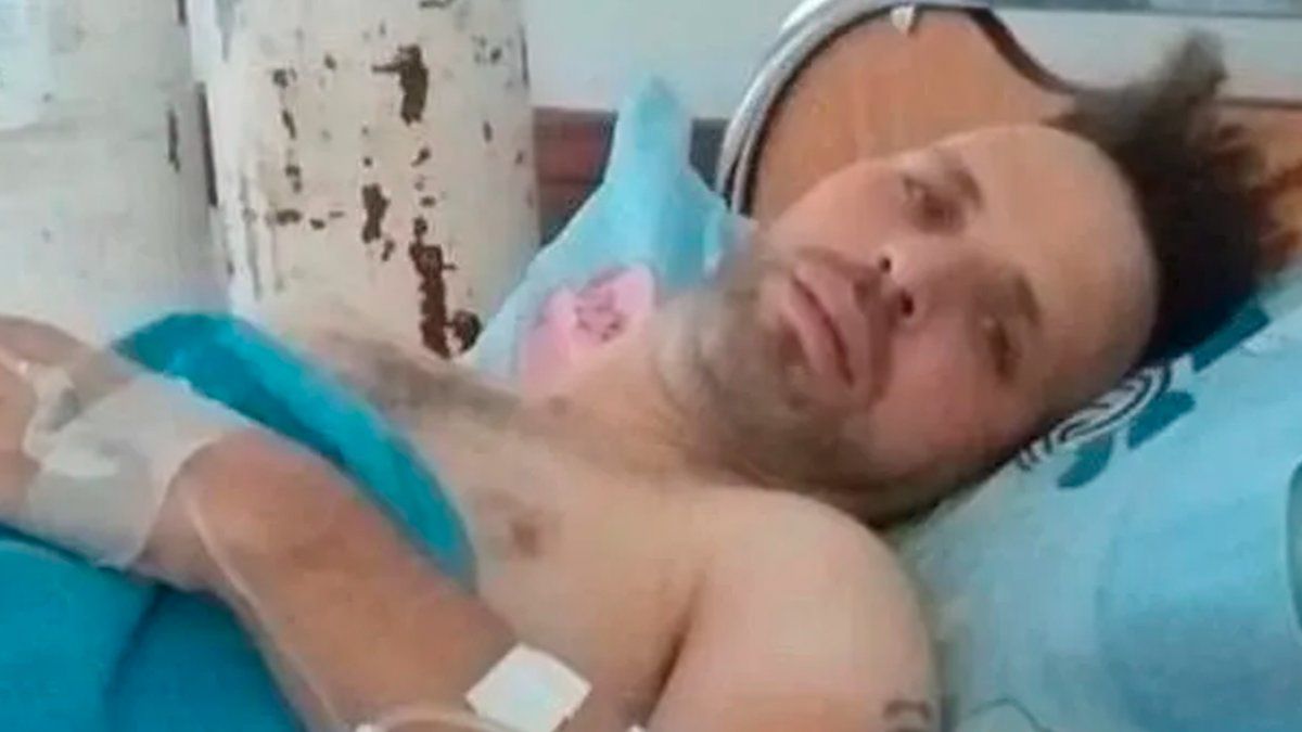 Bergalli&nbsp;estuvo 16 días hospitalizado&nbsp;con mucho dolor de cabeza y en el cuerpo