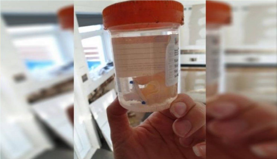 Se mudó y en su nueva casa encontró un órgano en un frasco