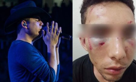 Remmy Valenzuela fue acusado de golpear brutalmente a su primo y a su novia Remmy Valenzuela fue acusado de golpear brutalmente a su primo y a su novia