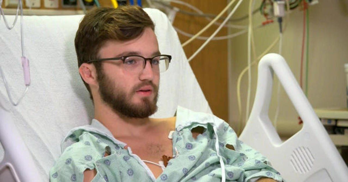 Joven de 18 años tiene los pulmones de una persona de 70 por consumir cigarrillos electrónicos