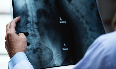 juguetes, crayones, bolas de golf y otros objetos ?olvidados? por pacientes dentro de sus cuerpos juguetes, crayones, bolas de golf y otros objetos ?olvidados? por pacientes dentro de sus cuerpos