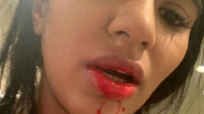 Video: la novia de Sebastián Villa denunció que fue brutalmente golpeada por el jugador de Boca