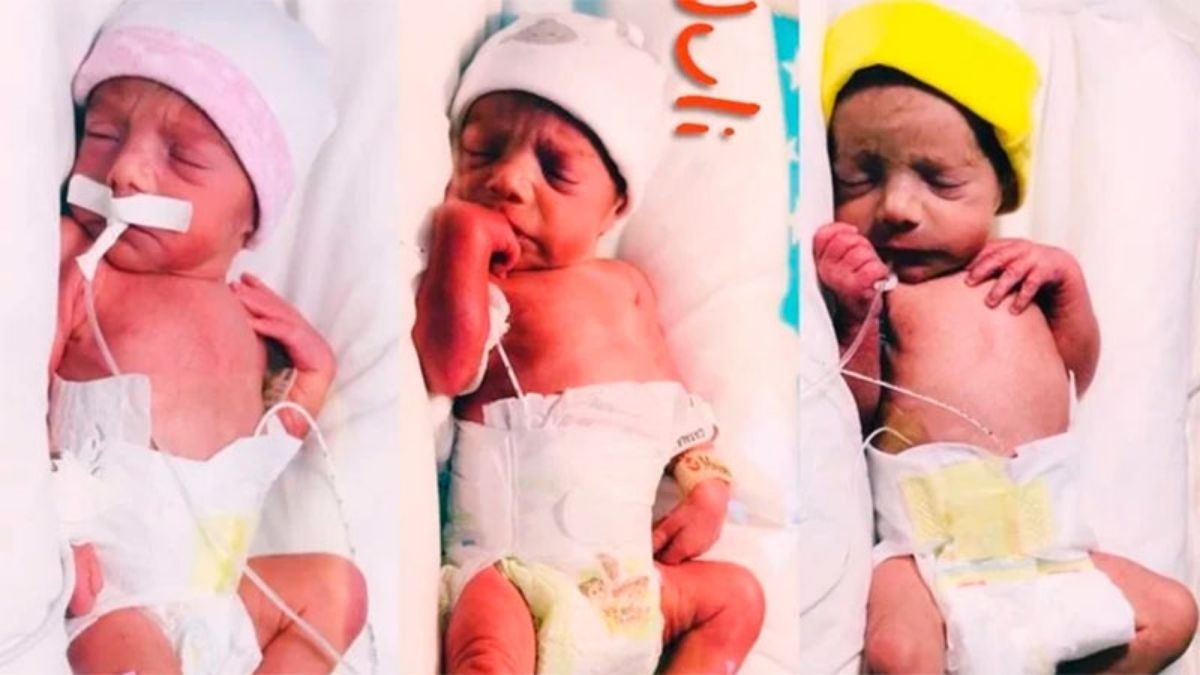 Las trigemelas id&eacute;nticas nacieron el 25 de diciembre en el Hospital Mar&iacute;a Humphreys de Trelew y permanecen internadas en neonatolog&iacute;a.