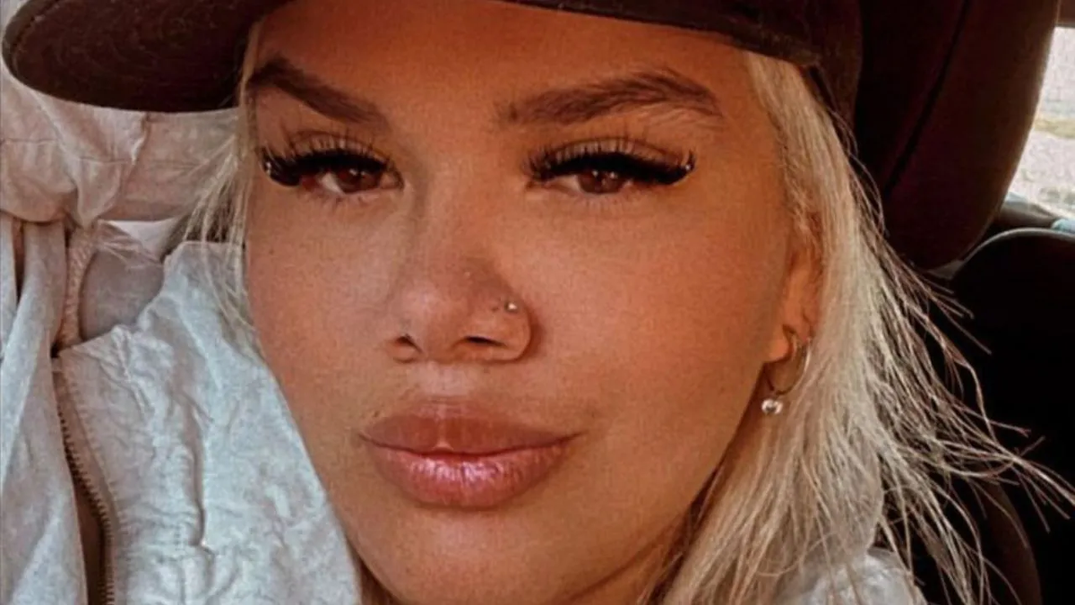 Morena Rial se hizo un fuerte retoque estético en medio de las denuncias por robo: las fotos