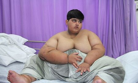 Una operación podría salvar la vida del niño de 10 años que pesa más de 190 kilos