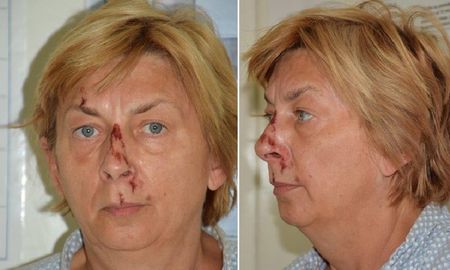 La mujer se encuentra actualmente hospitalizada.