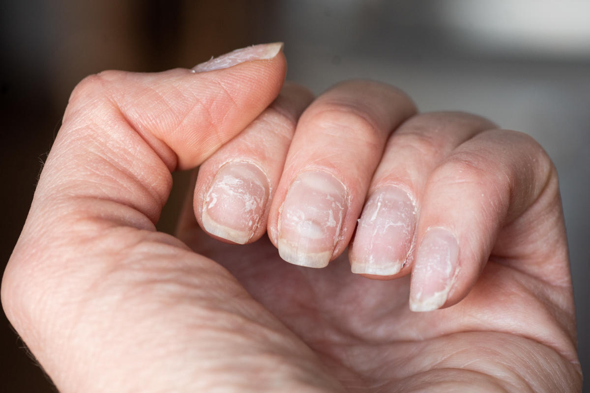 El cuidado de las uñas: más allá de la estética