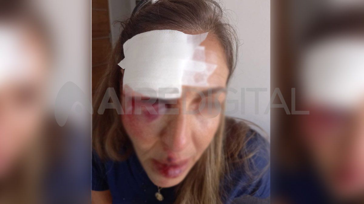 La mujer asaltada en el barrio Candioti Norte&nbsp;prefirió resguardar su identidad.