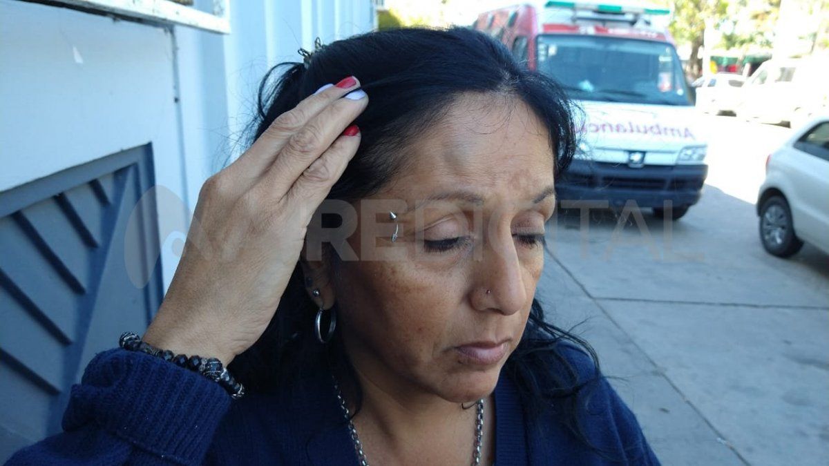 Producto de los golpes y las patadas que sufrió, la mujer quedó con moretones en su frente.