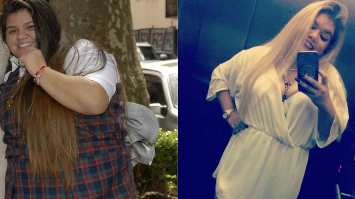 More Rial contó cómo era su vida antes de someterse al bypass gástrico