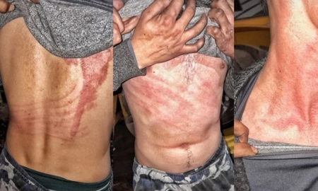 un joven asegura que sufrio el ataque de un fantasma: lo golpeo y arrastro varios metros un joven asegura que sufrio el ataque de un fantasma: lo golpeo y arrastro varios metros