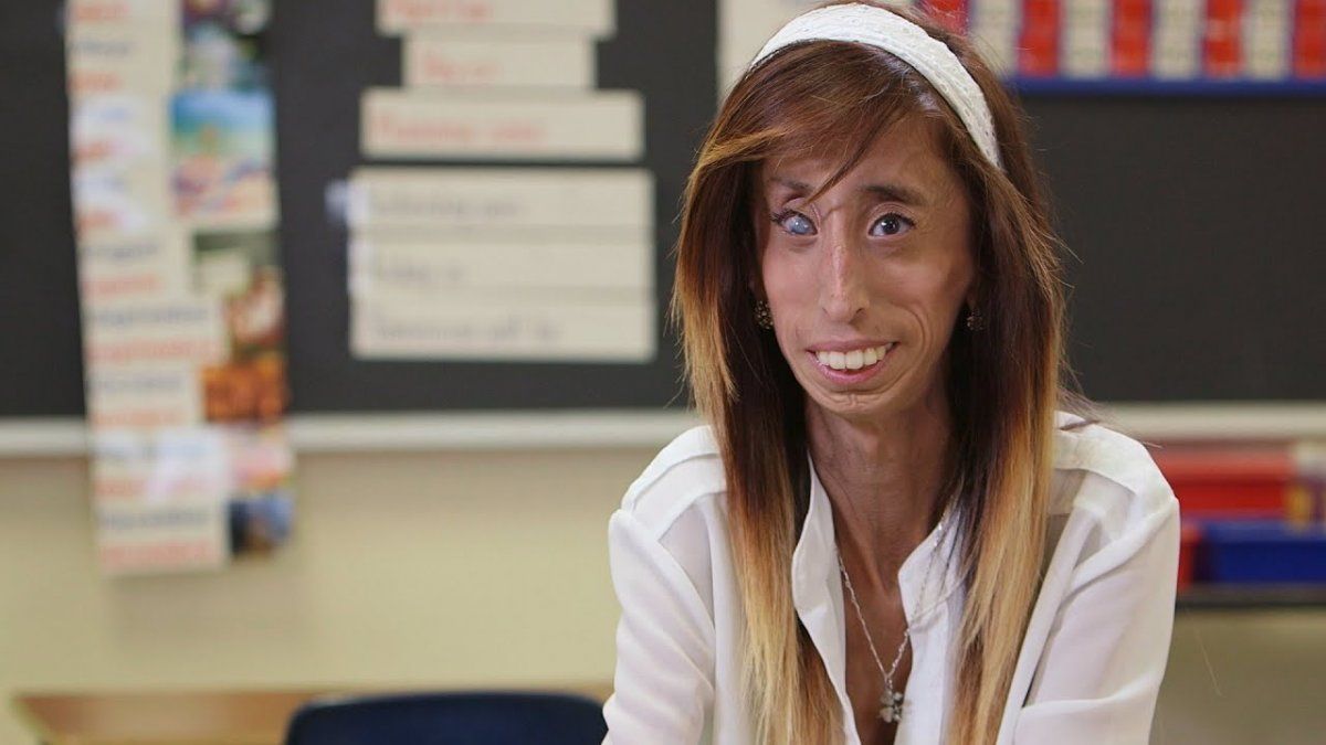 Lizzie Velasquez Pidi Que Dejen De Usar Su Cara Para Una Broma Cruel