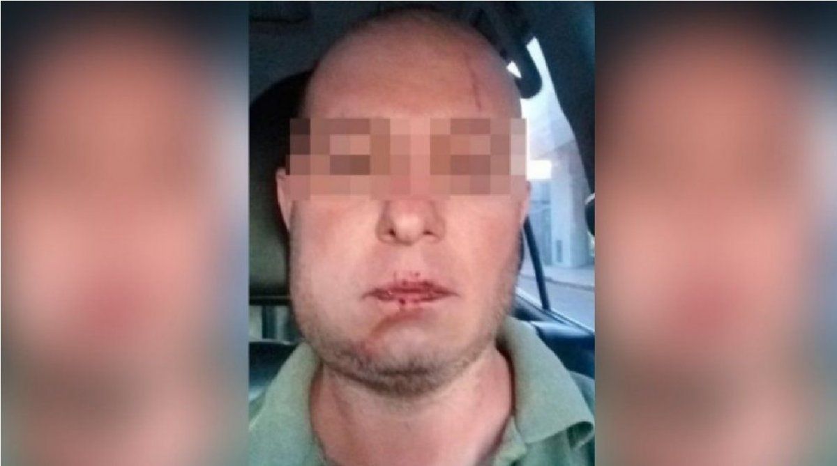 Cuatro policías detuvieron a un hombre por error y le quebraron la mandíbula