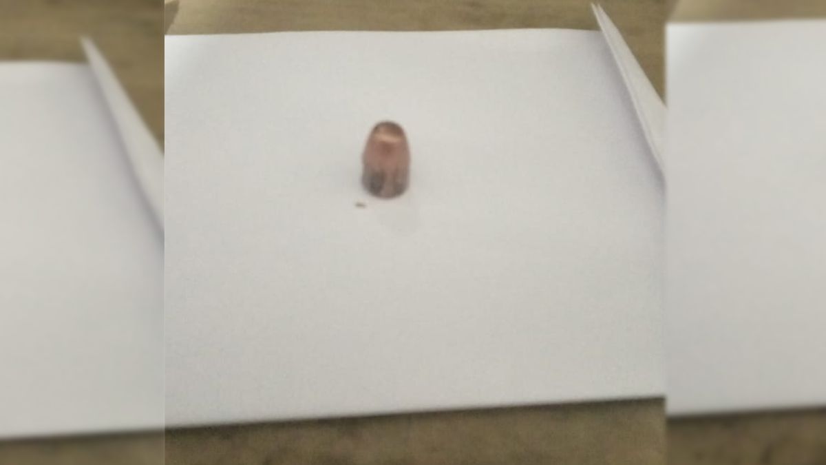 El proyectil sería de un arma de fuego calibre 9 milímetros.&nbsp;