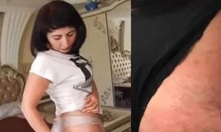 La historia de una mujer que sufre los daños de una cirugía estética