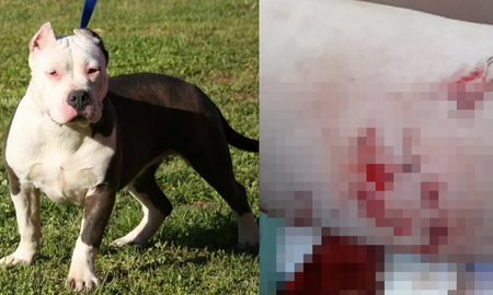 Defendió a su hermanita y fue brutalmente atacada por un pitbull: recibió 72 puntos y camina con ayuda de un andador Defendió a su hermanita y fue brutalmente atacada por un pitbull: recibió 72 puntos y camina con ayuda de un andador