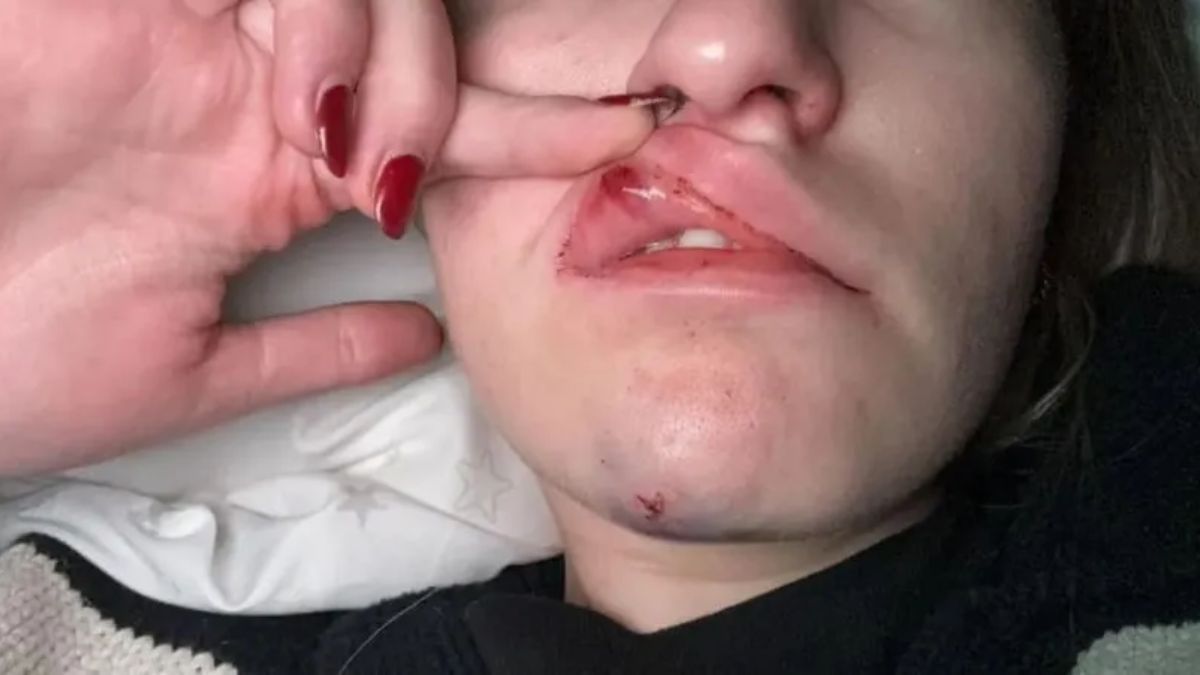 La joven que denunció a Nicolás Garrido por violencia de género. La joven que denunció a Nicolás Garrido por violencia de género.