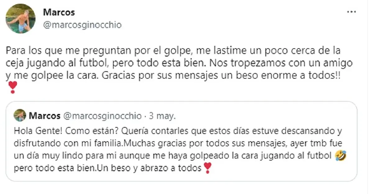 Marcos Ginocchio sufrió un accidente y preocupó a sus fans.