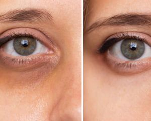 Una especialista en estética compartió una rutina simple con un solo ingrediente vegetal Una especialista en estética compartió una rutina simple con un solo ingrediente vegetal