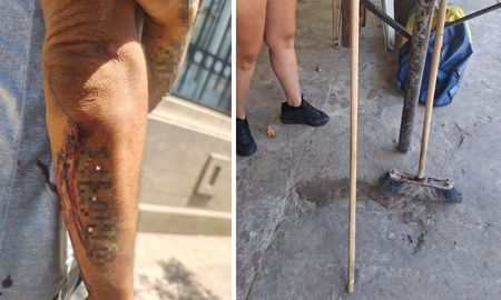 Santa Fe: agredido con un palo de escoba Santa Fe: agredido con un palo de escoba