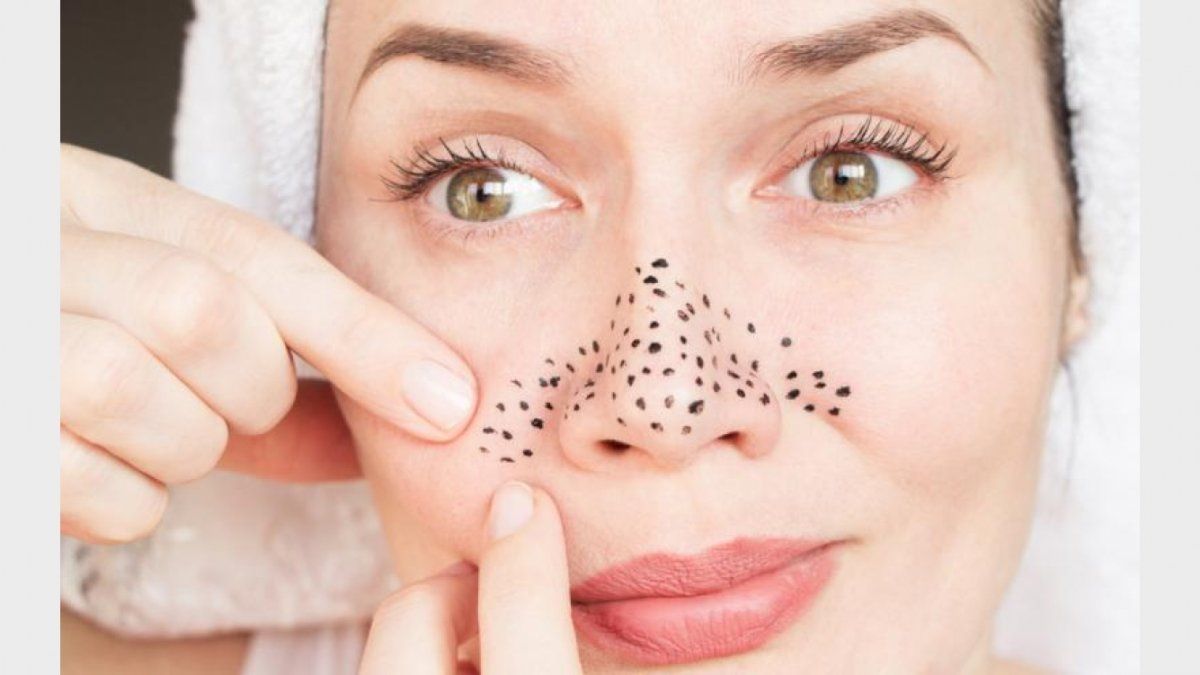 C&oacute;mo eliminar los puntos negros de manera efectiva y natural.